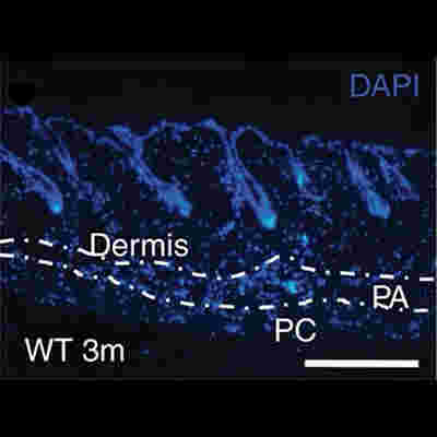 Kallistatin affects skin structure and function.
