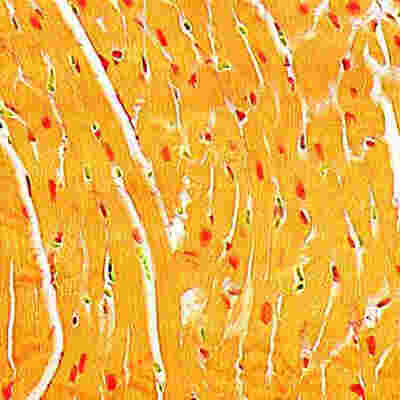 Effects of metformin on cardiac function in Type 1 diabetes.