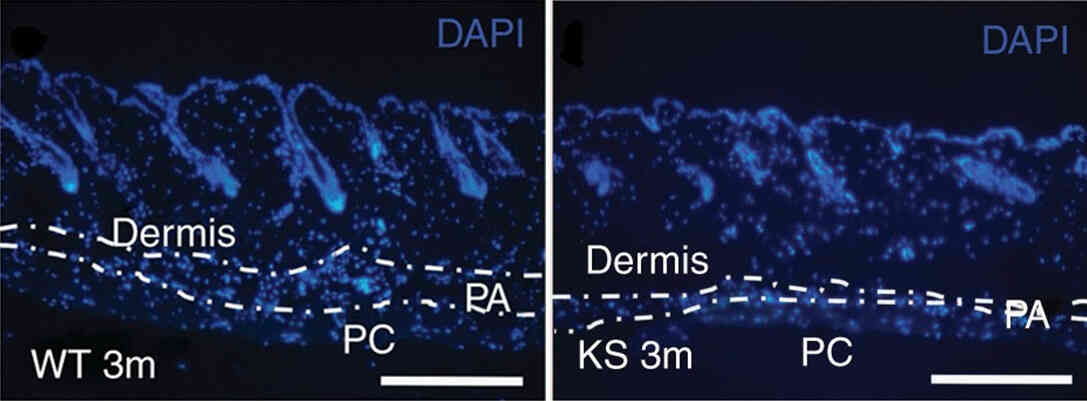 Kallistatin affects skin structure and function.