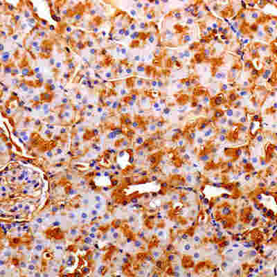 Cultured retinal cells